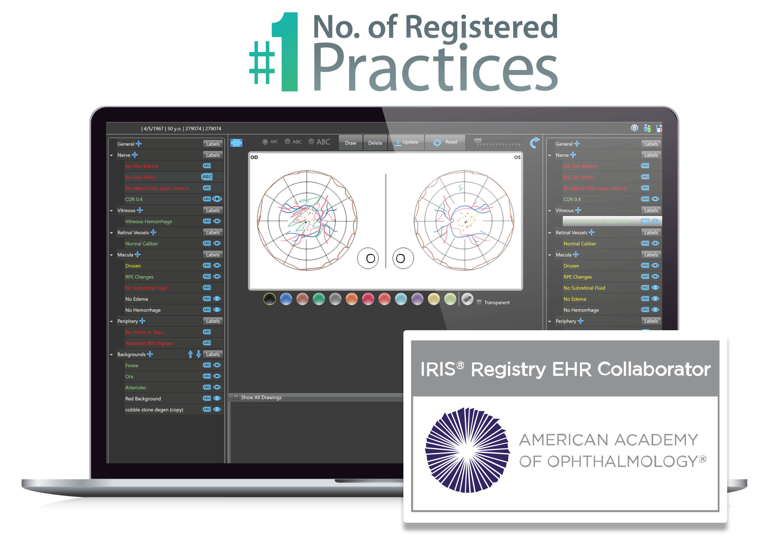 Ophthalmology electronic health records